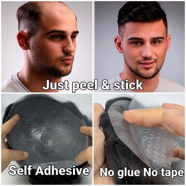 Self-Adhesive Peel & Stick Hair Replacement System