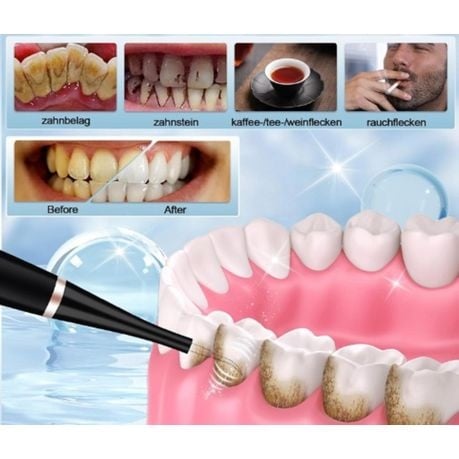 Electric Tooth Cleaner Adult Powerful Toothbrush With Plaque Remover - Black