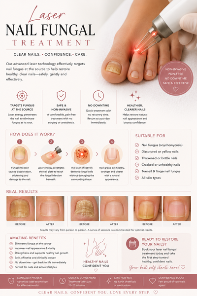 Laser Fungal Nail Treatment picture