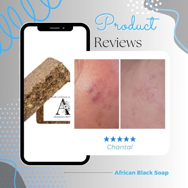 African Black Soap Review, Chantal