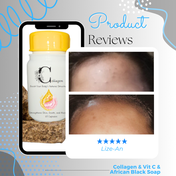 Radiance Wellness Set Review, Lize-An