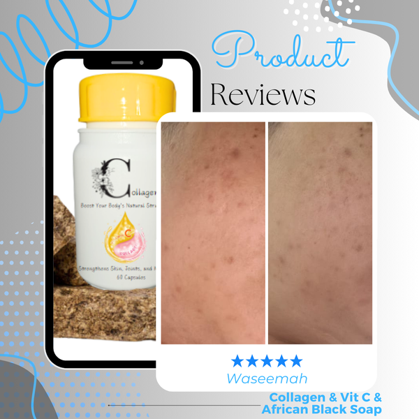 SkinGlow Combo Review, Waseemah