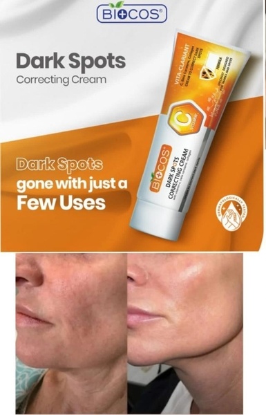 Biocos Dark Spot Correcting Cream - dark spots gone in just a few uses