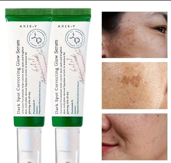 Dark spot correcting glow serum